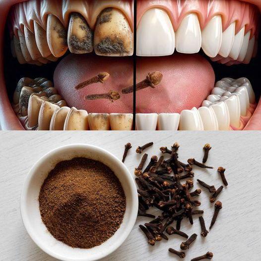 9 naturalnych sekretów jaśniejszego uśmiechu: pozbądź się płytki nazębnej i kamienia nazębnego!!