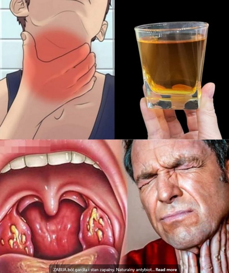 Tytuł: Naturalny antybiotyk na ból gardła i stany zapalne – domowy eliksir, który działa