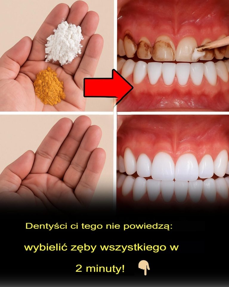 Kamień nazębny – domowy sposób z sodą i kurkumą, który naprawdę działa