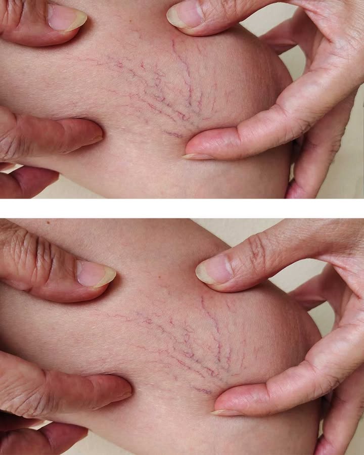 Co mogę zrobić w międzyczasie?