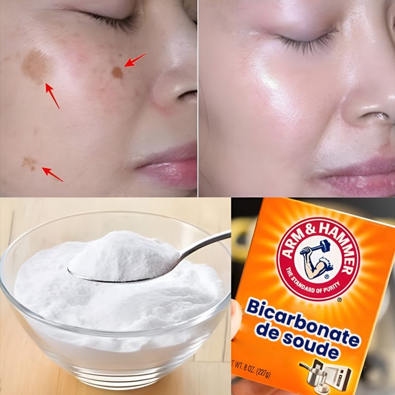 4 sposoby na usunięcie plam starczych za pomocą sody oczyszczonej, aby uzyskać młodzieńczą, równomierną skórę