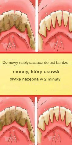 Usuń płytkę nazębną naturalnie w 5 minut, bez wizyty u dentysty