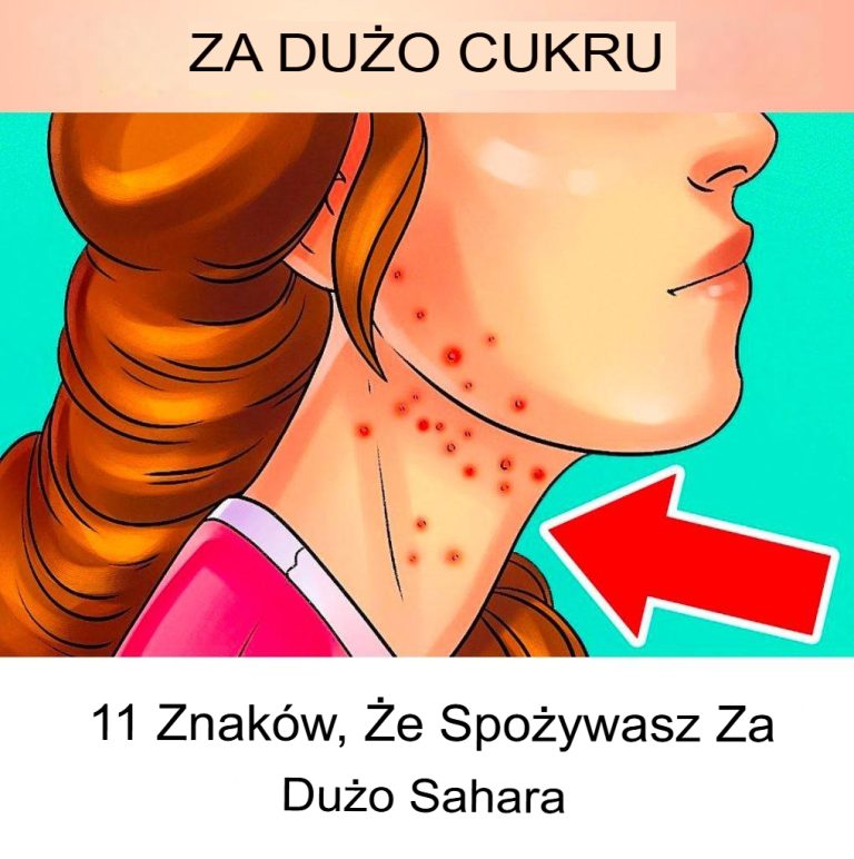 11 oznak, że jesz za dużo cukru