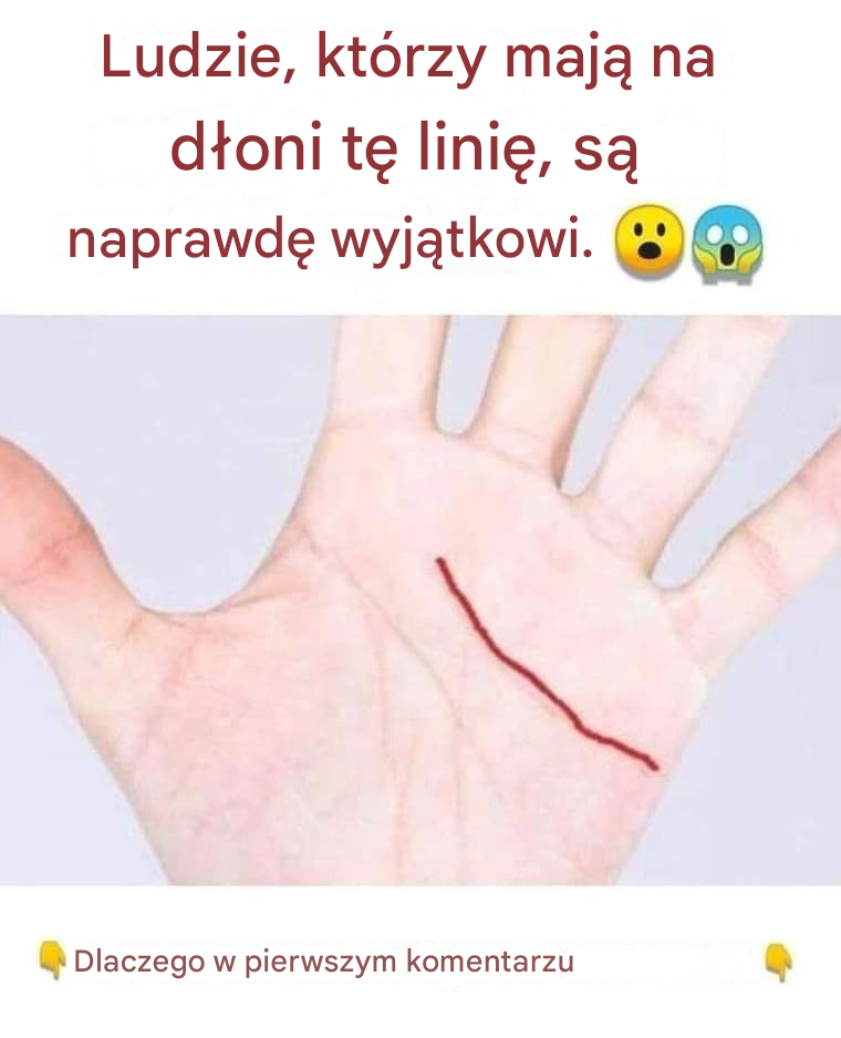 Ludzie, którzy mają na dłoni tę linię, są naprawdę wyjątkowi.