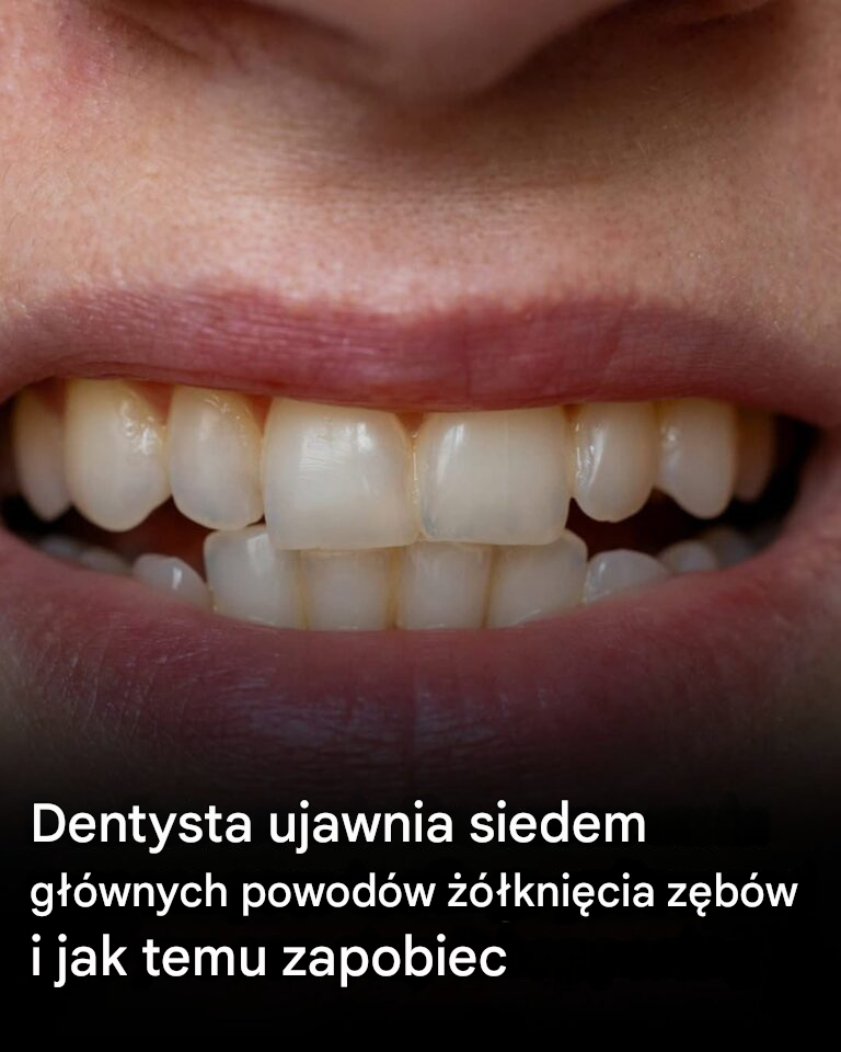 Dentysta wyjaśnia 7 głównych przyczyn żółknięcia zębów i jak temu zapobiegać