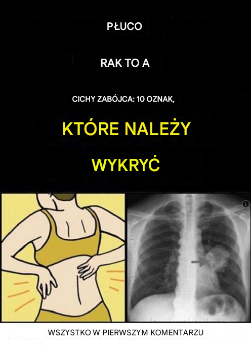 6 wskazówek od pulmonologa, jak zadbać o płuca