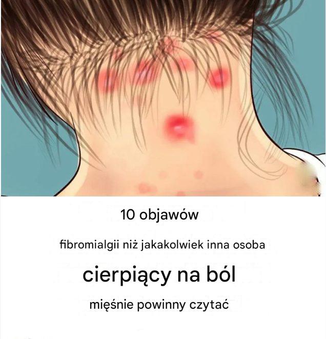 10 objawów fibromialgii, które każdy z bólem mięśni powinien przeczytać