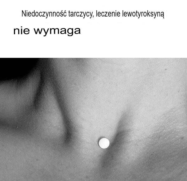 Niedoczynność tarczycy – nie musisz stosować lewotyroksyny