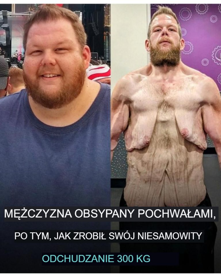 Internet chwali mężczyznę, który schudł 360 kg