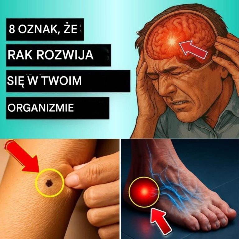 20 wczesnych oznak, że twoje ciało walczy z rakiem