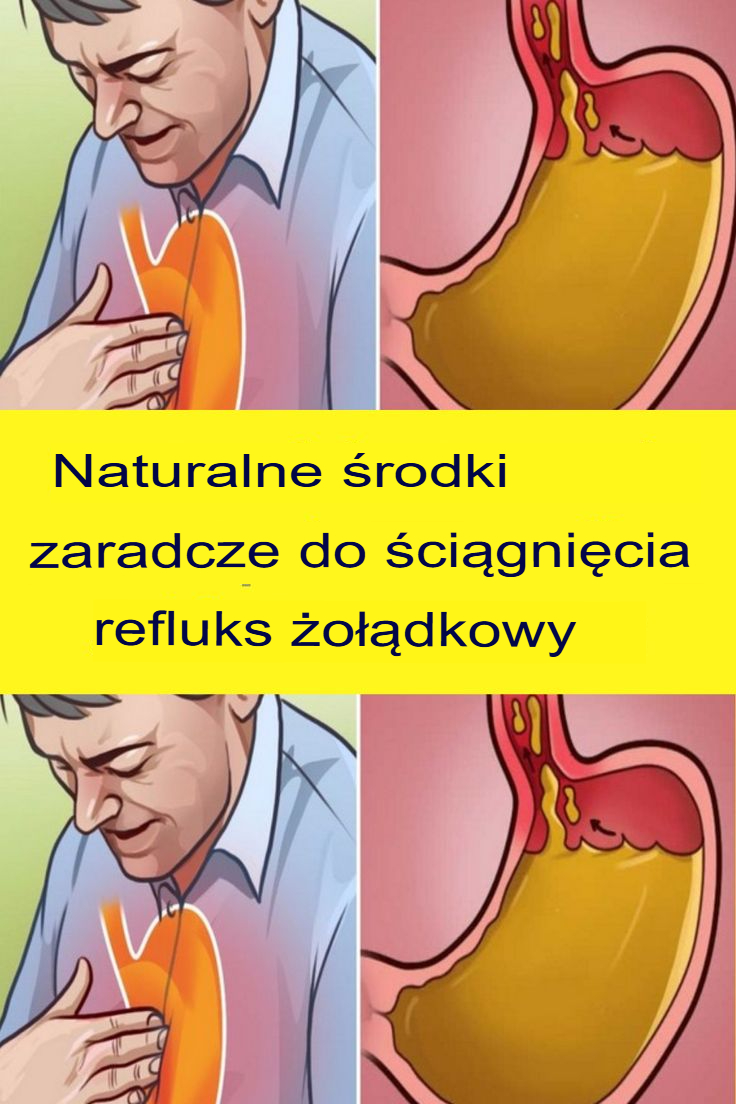 Naturalne środki łagodzące refluks żołądkowy