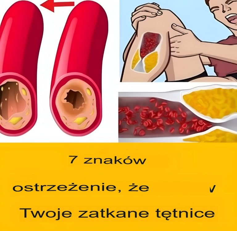 7 ostrzegawczych znaków, że Twoje tętnice są zatkane