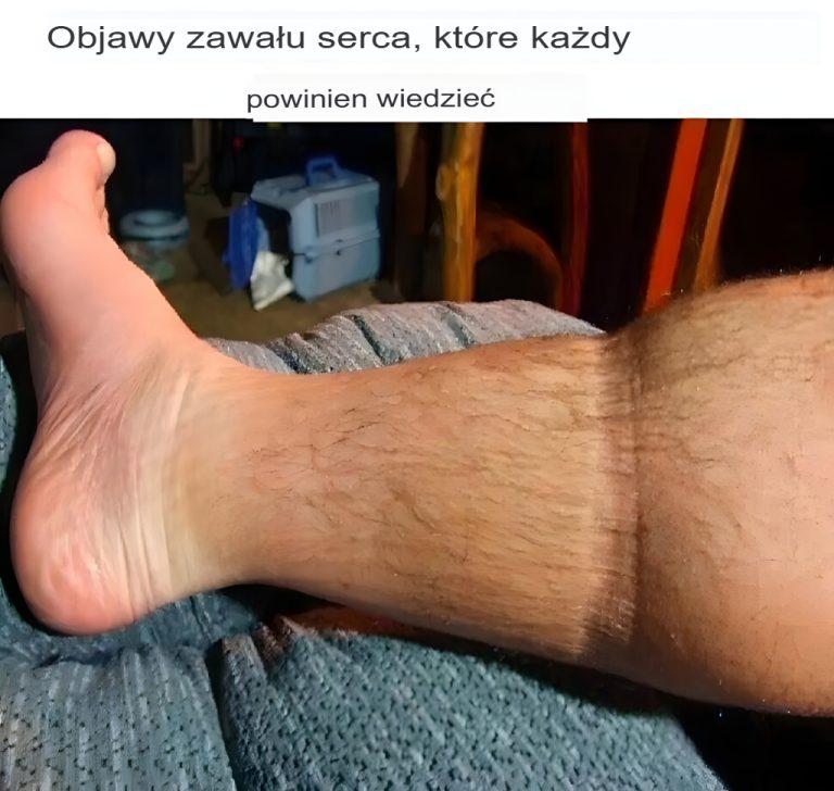 Objawy zawału serca, które każdy powinien znać❗