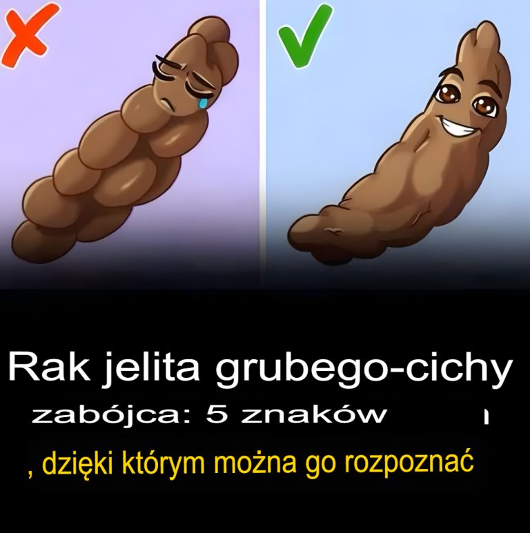 Rak jelita grubego to cichy zabójca: 5 objawów, które pomogą wykryć go wcześnie...