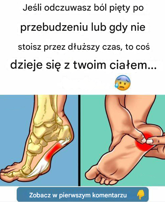 Zalecane ćwiczenia w leczeniu zapalenia powięzi podeszwowej