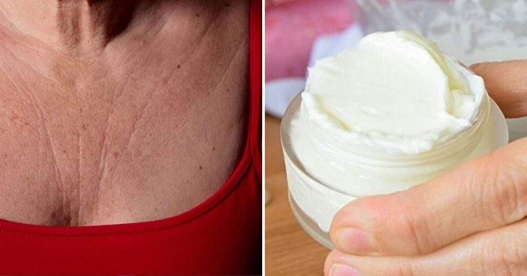 Jak szybko zredukować zmarszczki na szyi i klatce piersiowej