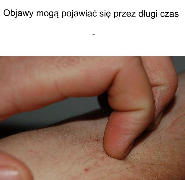 Znajomość objawów choroby wątroby może uratować Ci życie