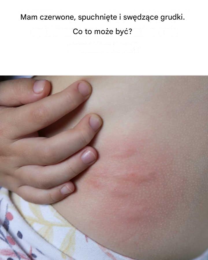 Och, to jest takie denerwujące