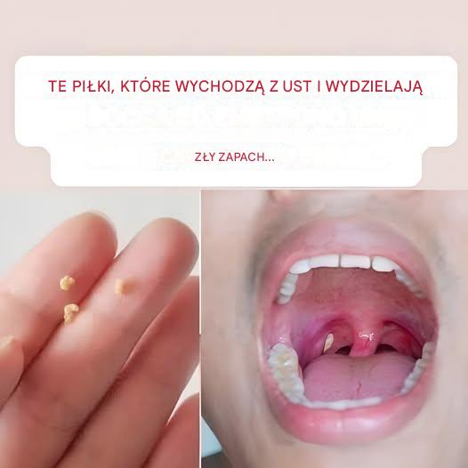 Nieświeży oddech: Domowy sposób na świeży oddech