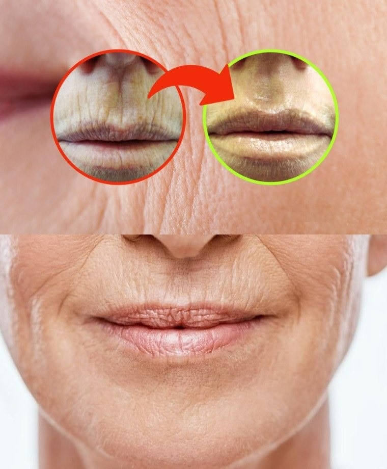 ZMARSZCZKI NA USTACH, NIE TRAW CZASU NA KREMY: ROZWIĄZANIE TKWI W TWOIM PANELU