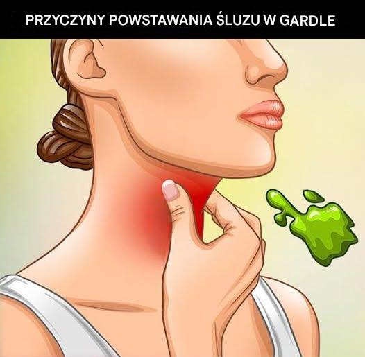Prawdziwe przyczyny ciągłego zalegania śluzu w gardle i jak się go pozbyć