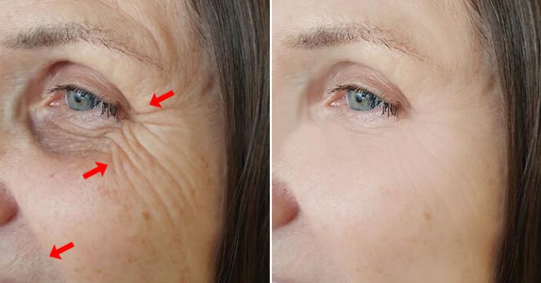 5 niezbędnych witamin dla cery porcelanowej