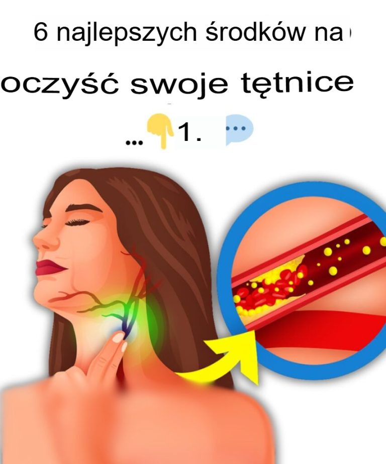 6 najlepszych sposobów na oczyszczenie tętnic