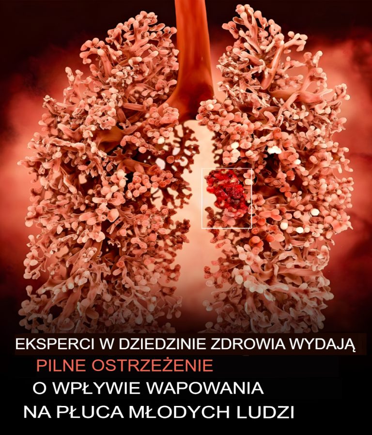 Eksperci ostrzegają przed „płucami popcornu” w wyniku wapowania