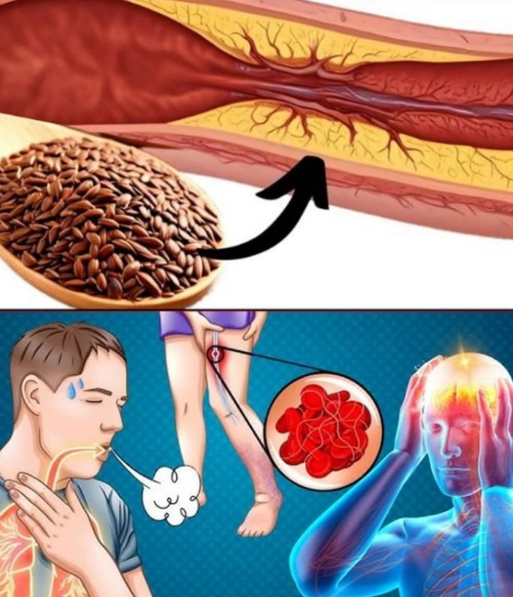 Serce pod ochroną: domowa łyżka zdrowia na krążenie, zakrzepy i ciśnienie