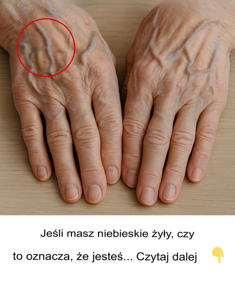 Dlaczego żyły stają się bardziej widoczne z wiekiem