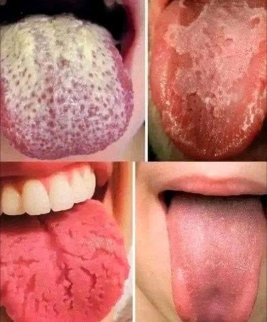 Jeśli masz te cztery objawy na języku, mogą one być oznaką ukrytych problemów zdrowotnych.