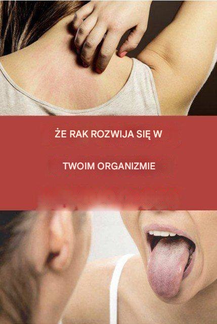 19 ostrzegawczych znaków, że rak rozwija się w twoim ciele