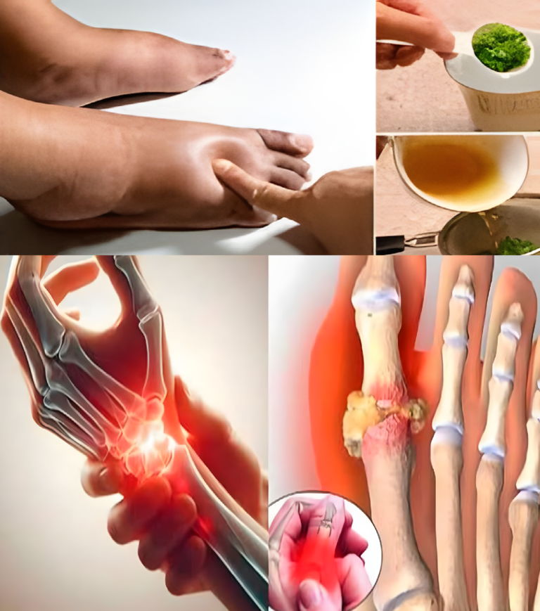 Najlepsza herbata na opuchnięte nogi: naturalny środek moczopędny na kostki i stopy