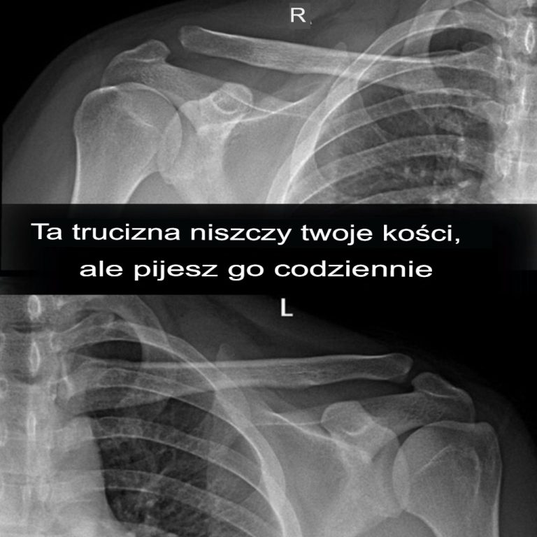 Co się dzieje, gdy pijesz napój gazowany?