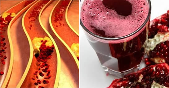 Jak udrożnić tętnice i obniżyć poziom cholesterolu za pomocą owoców