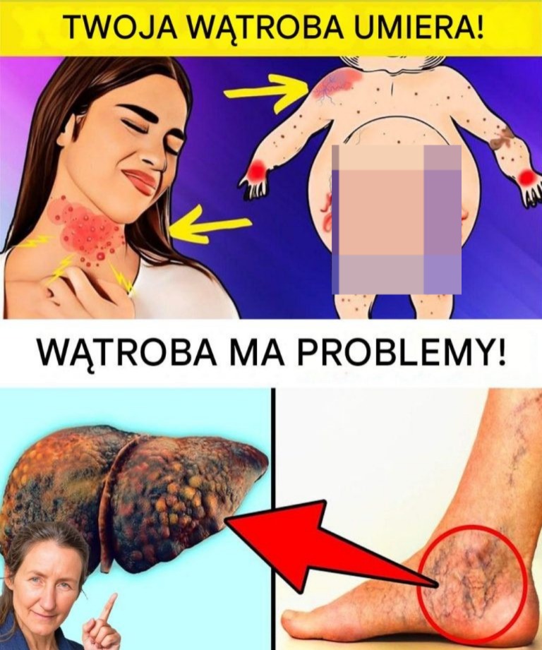 Co Twoje Stopy Mogą Ci Powiedzieć O Twoim Zdrowiu: Na Co Należy Zwracać Uwagę, W Tym Problemy Z Wątrobą