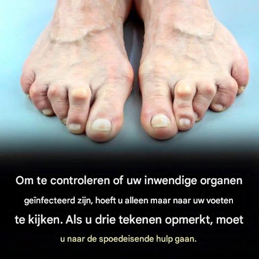 Nocne skurcze nóg? Dowiedz się, dlaczego się pojawiają i jak je złagodzić!