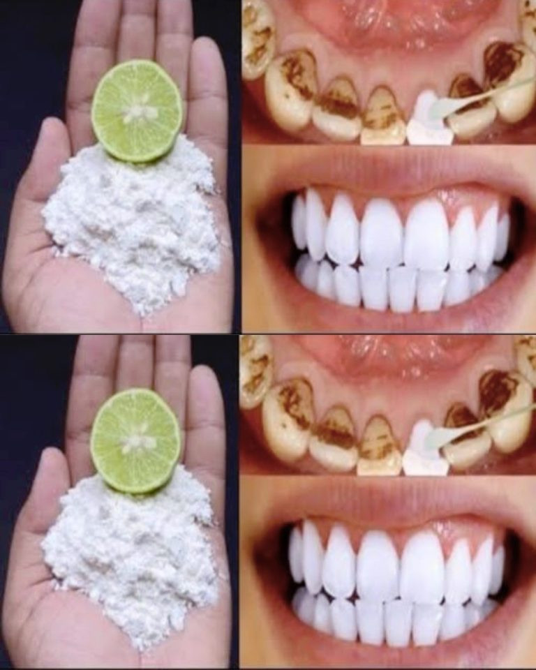 Dodatek imbiru pomoże wybielić zęby i odświeżyć oddech