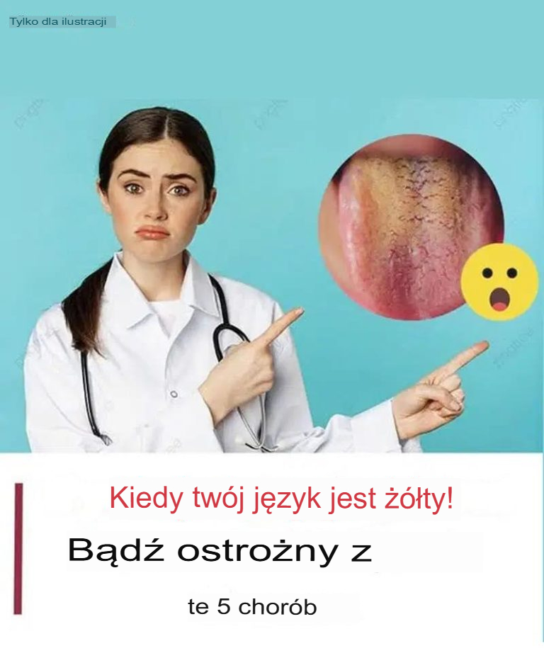 Mengsel van Vaseline en café: dlaczego nie wiedziałem o tym wcześniej?**