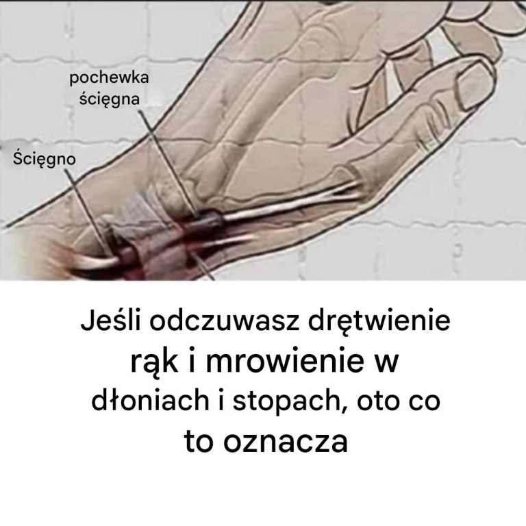 Czy często masz odrętwiałe ręce? Dowiedz się, co może być przyczyną