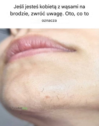 Co wąsy podbródkowe mogą powiedzieć o Twoim zdrowiu?