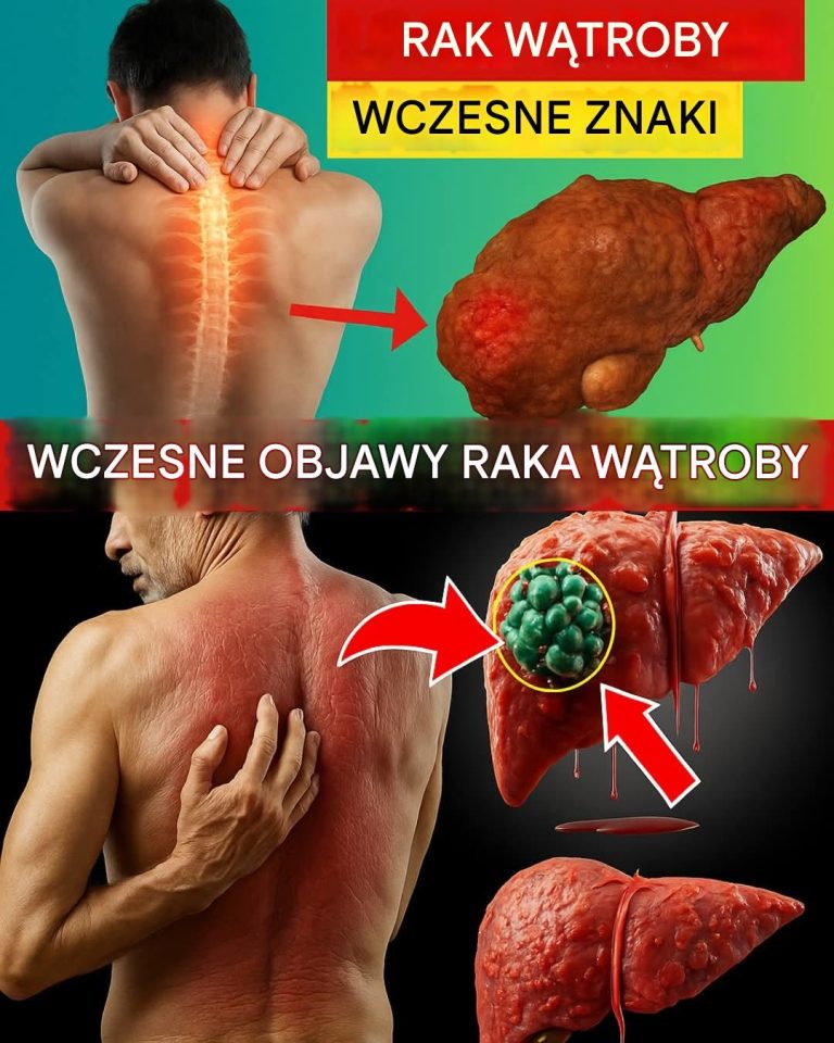 Czy Twoja wątroba wysyła ciche SOS? Odkryj 12 ukrytych objawów marskości wątroby, na które musisz zareagować natychmiast!