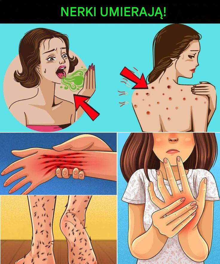 15 śmiertelnych objawów chorób nerek, które musisz wykryć wcześnie