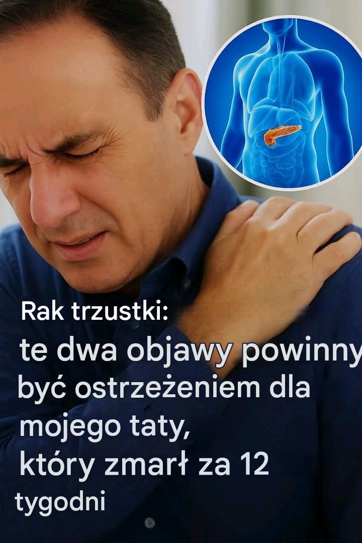 Rak trzustki: 10 objawów, które pomogą Ci go wykryć (nie ignoruj ​​ich)