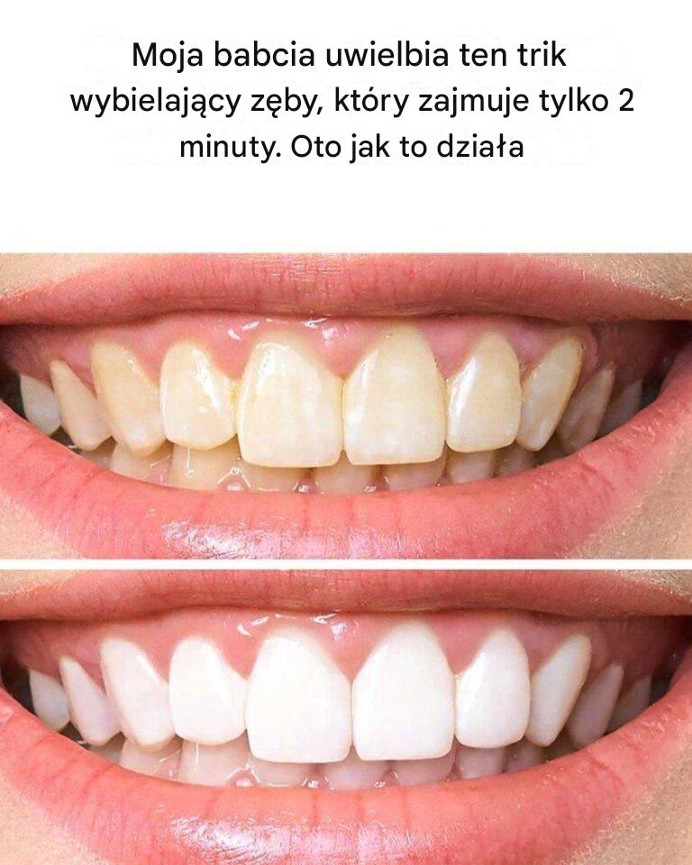 Przewodnik krok po kroku, jak wybielić zęby w 2 minuty
