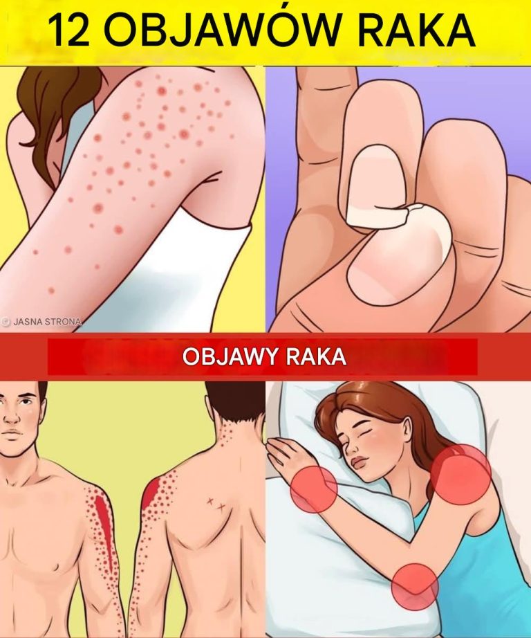 12 wczesnych sygnałów ostrzegawczych, że w Twoim organizmie mogą rozwijać się komórki rakowe