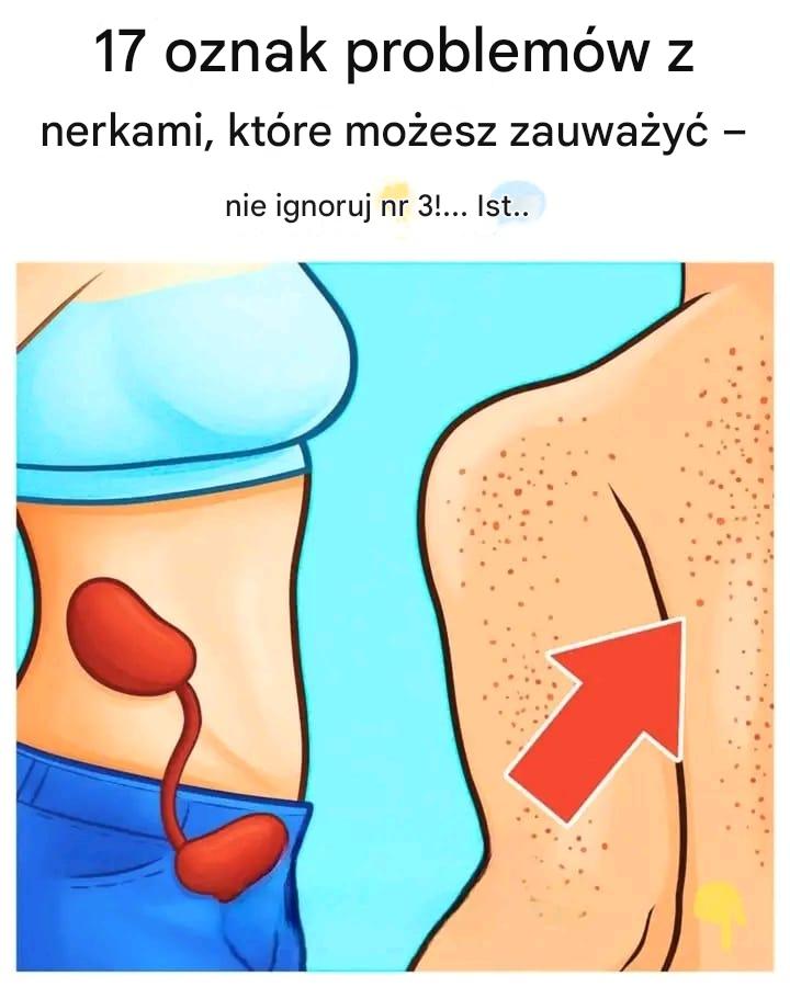 17 oznak problemów z nerkami, które możesz zauważyć — nie ignoruj ​​nr 3!