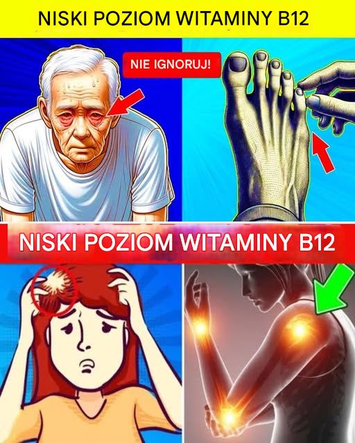 9 PILNYCH OBJAWÓW NIEDOBORU WITAMINY B12, KTÓRYCH NIGDY NIE NALEŻY ignorować