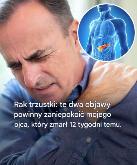 Rak trzustki: 10 objawów, które pomogą Ci go wykryć (nie ignoruj ​​ich)