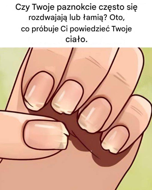 Oto 8 wskazówek, jak zapobiec łamaniu się paznokci